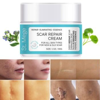 #9. St. Mege Scar Removal-Stretch Mark Removal Cream