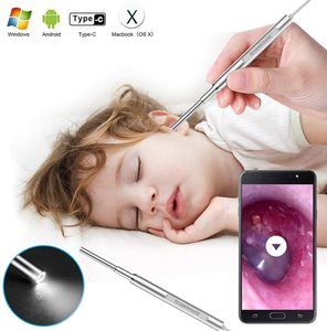 6. Scopearound 2019 Visual Ultra-Slim HD Ear Scope