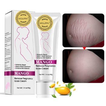 #8. RtopR Mango Stretch Marks and Scar Cream